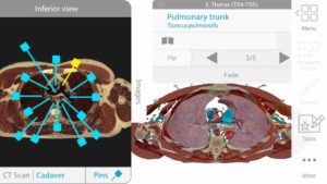 Human-Anatomy-Atlas-2018 6