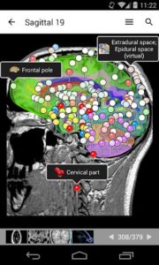 E-Anatomy 3